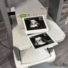 MIndray DP-50 with Sony Printer