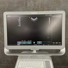 high resolution ultrasound imaging on Siemens NX2 system