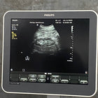Philips Ultrasound