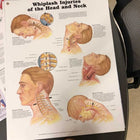 Anatomical Laminated Chart (New) - NMD -Angelus Medical