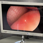 Circon Acmi Lap 5-30 MA Rigid Laparoscope 30 degree (Used) - ACMI -Angelus Medical
