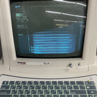 Esaote Biosound Portable Ultrasound (Used) - Esaote -Angelus Medical