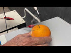 Conmed 5000 ESU in Action at Angelus Medical & Optical