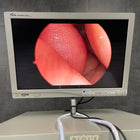 Linvatec 253425 Laparoscope 30' 5mm (Used) - Linvatec -Angelus Medical