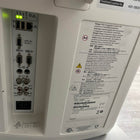 Siemens Acuson X150 Diangostic Ultrasound - Siemens -Angelus Medical