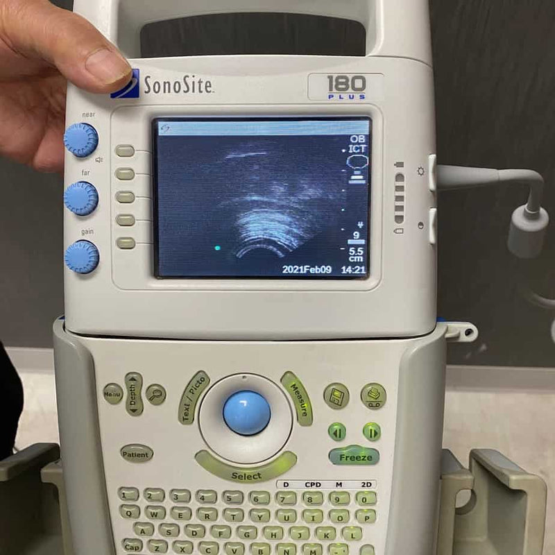 Sonosite 180 plus Portable ultrasound Complete Set (As Is) - Sonosite -Angelus Medical