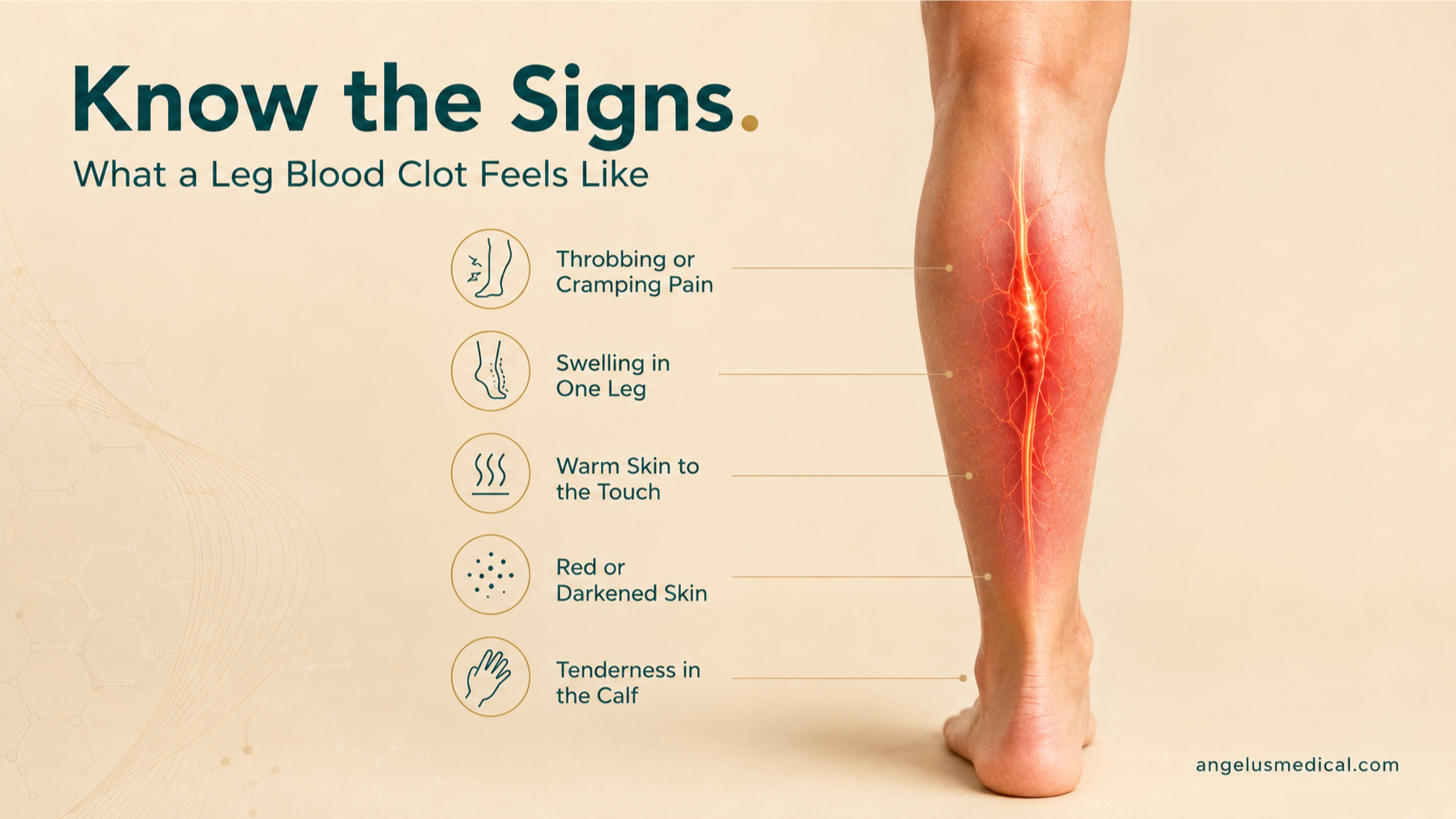 What Does a Blood Clot in the Leg Feel Like?