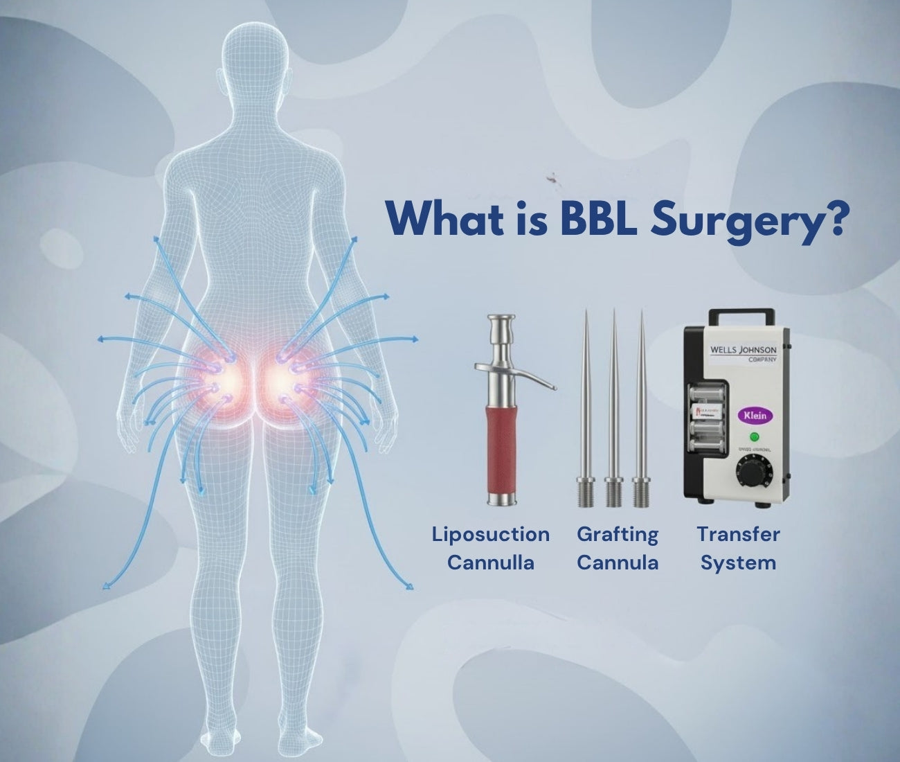 What Is BBL Surgery and How Does It Enhance Shape – Angelus Medical and ...