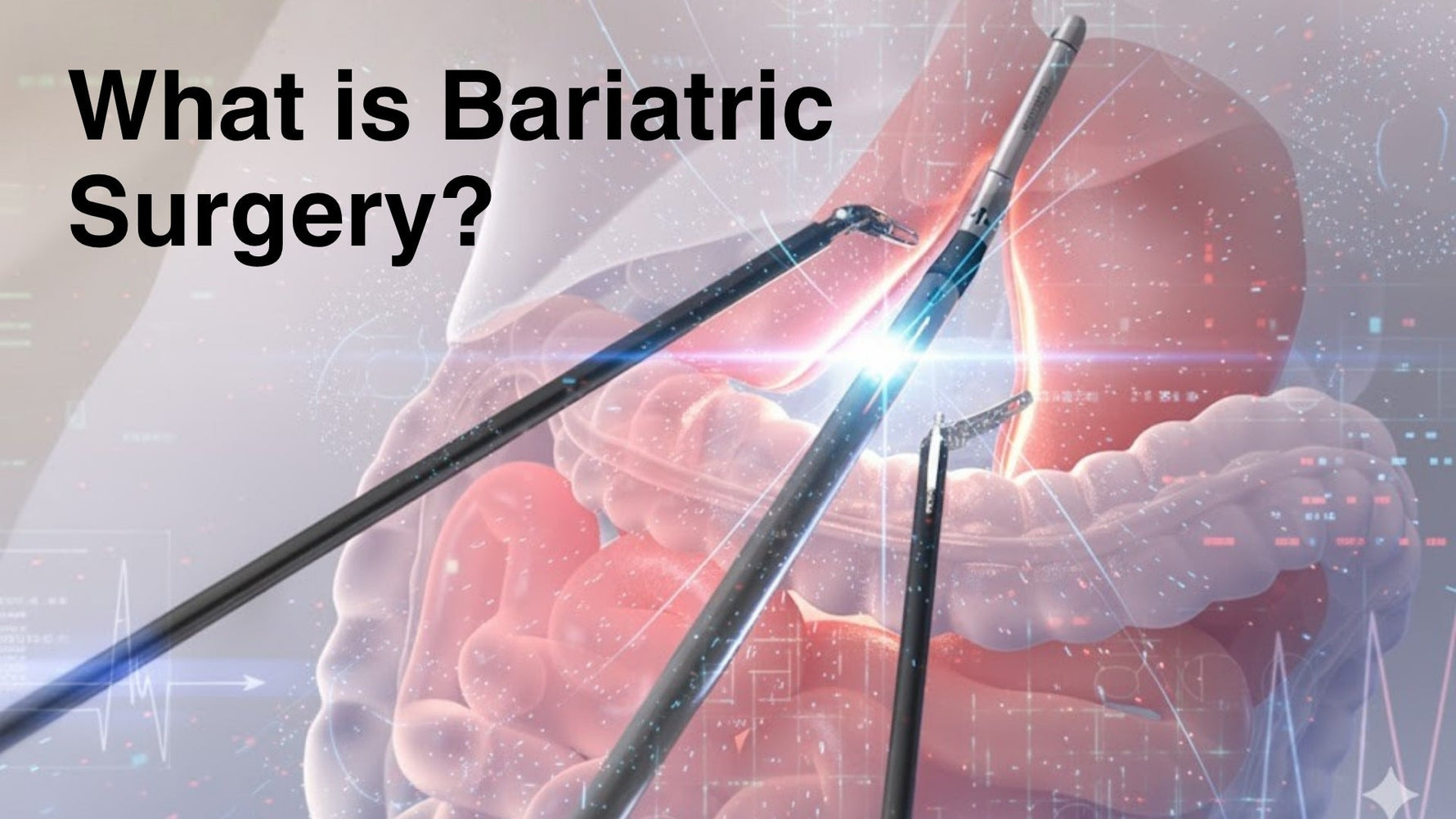 What Is Bariatric Surgery?