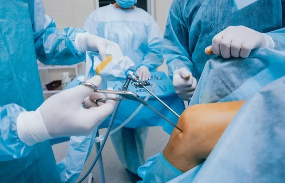Arthroscopy graspers including alligator graspers soft tissue graspers rat tooth graspers and tissue retrievers for orthopedic surgery