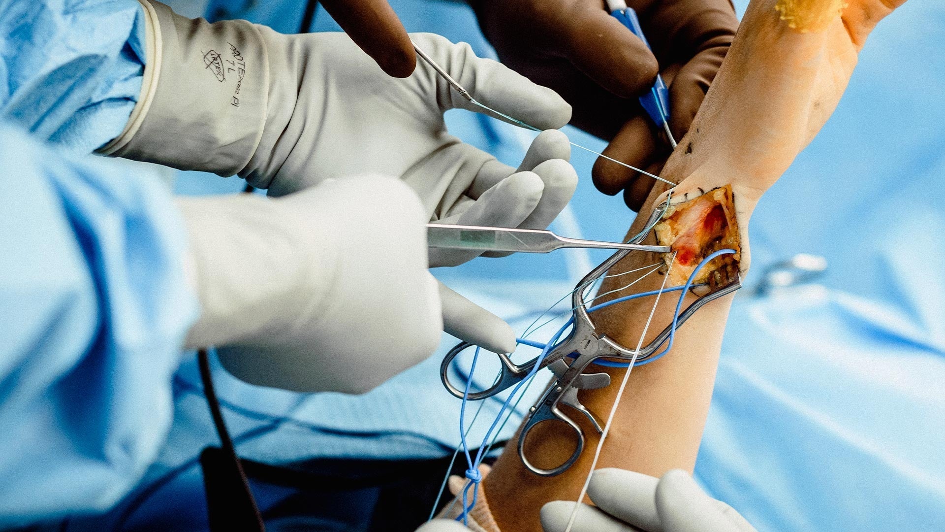 Arthroscopy Surgical Scissors for Orthopedic & Sports Medicine Applications