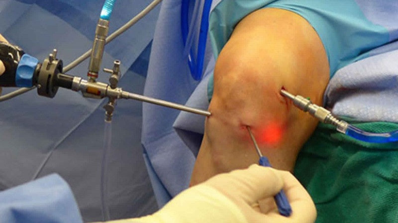 Arthroscopy instruments including graspers, punches, scissors and probes used in orthopedic and sports medicine surgery