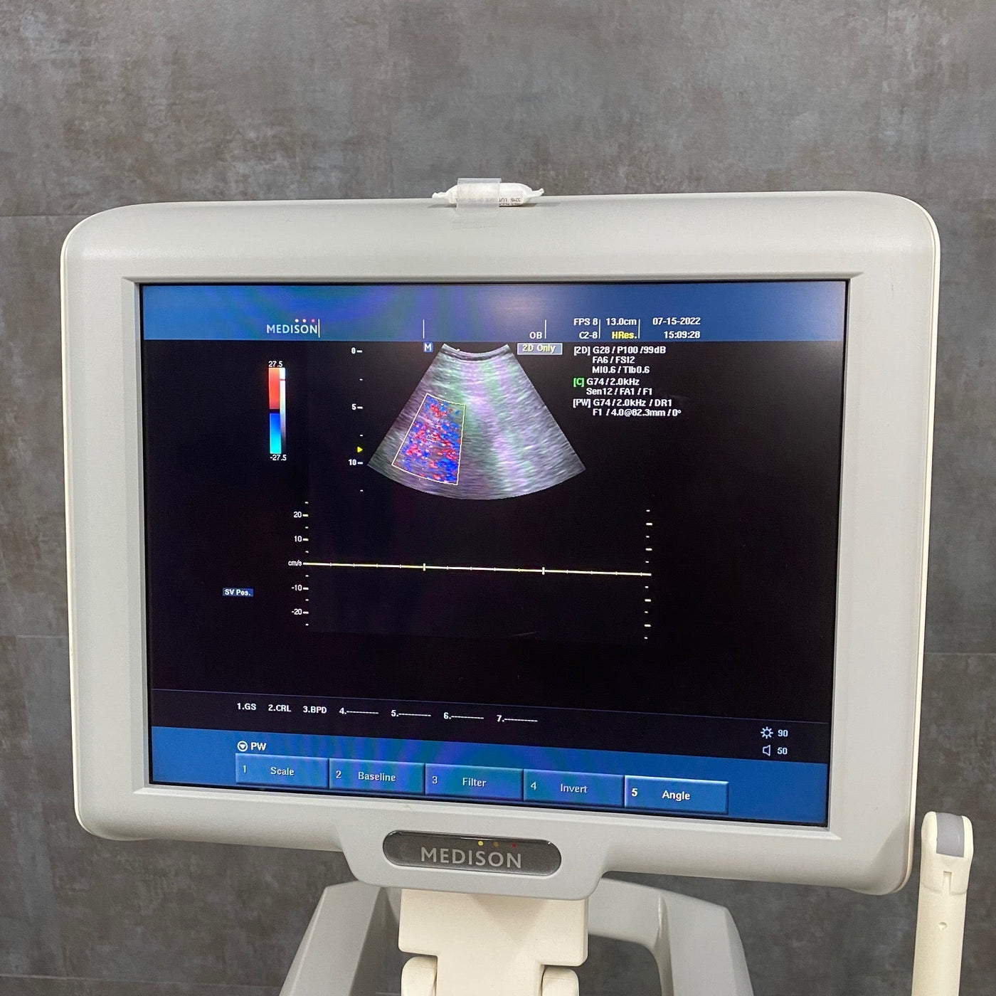 Diagnostic Ultrasound Machine