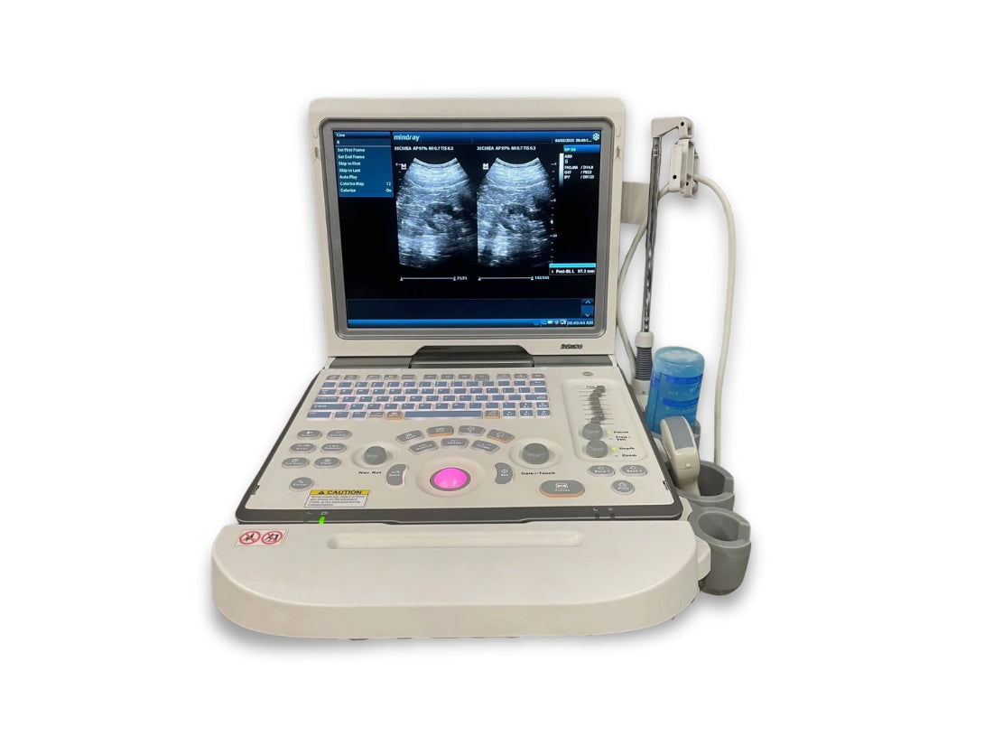 Ultrasounds sonograms Therapeutic ultrasounds