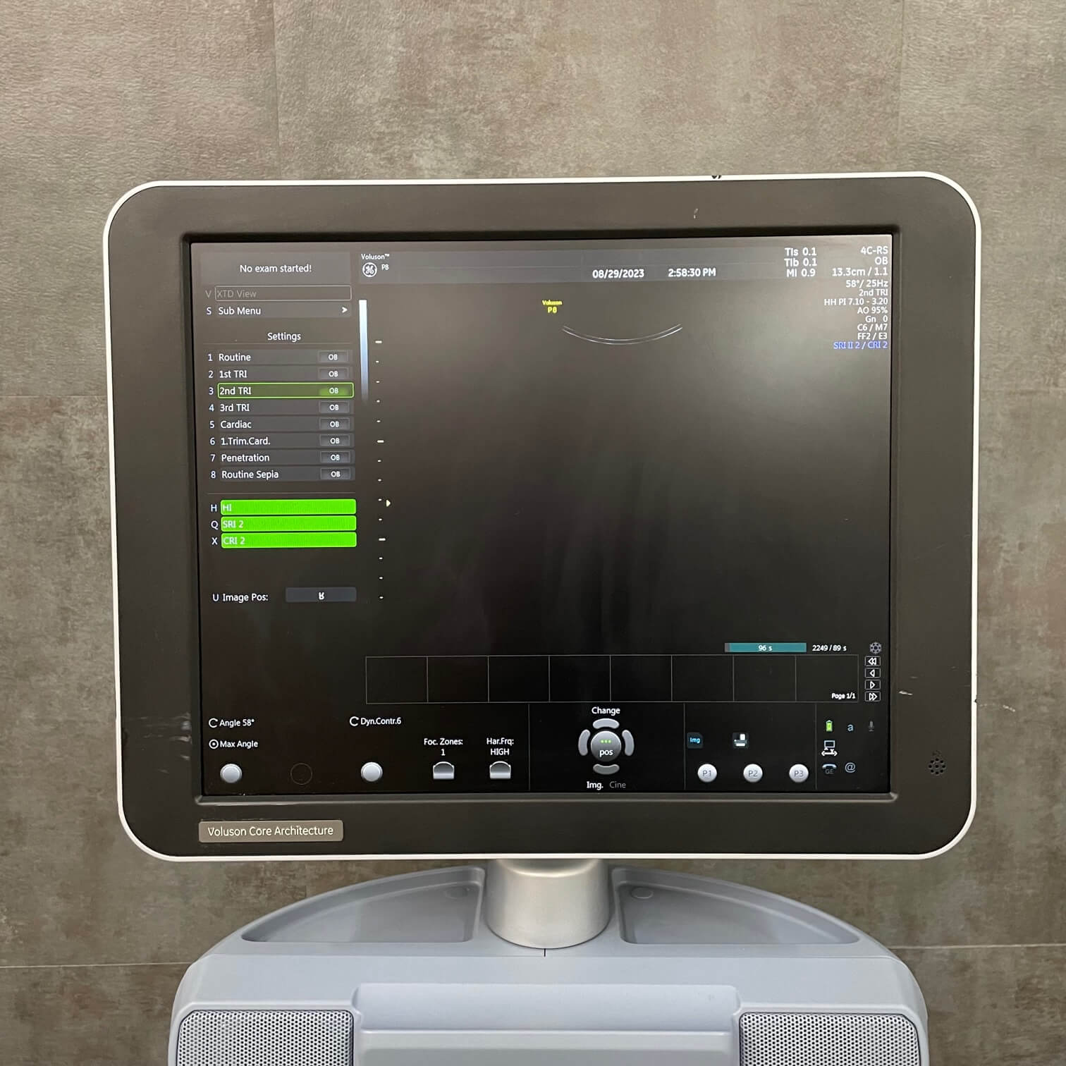 GE Voluson P8 Ultrasound - Angelus Medical