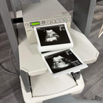 MIndray DP-50 with Sony Printer