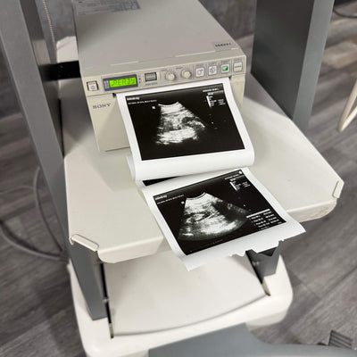 MIndray DP-50 with Sony Printer