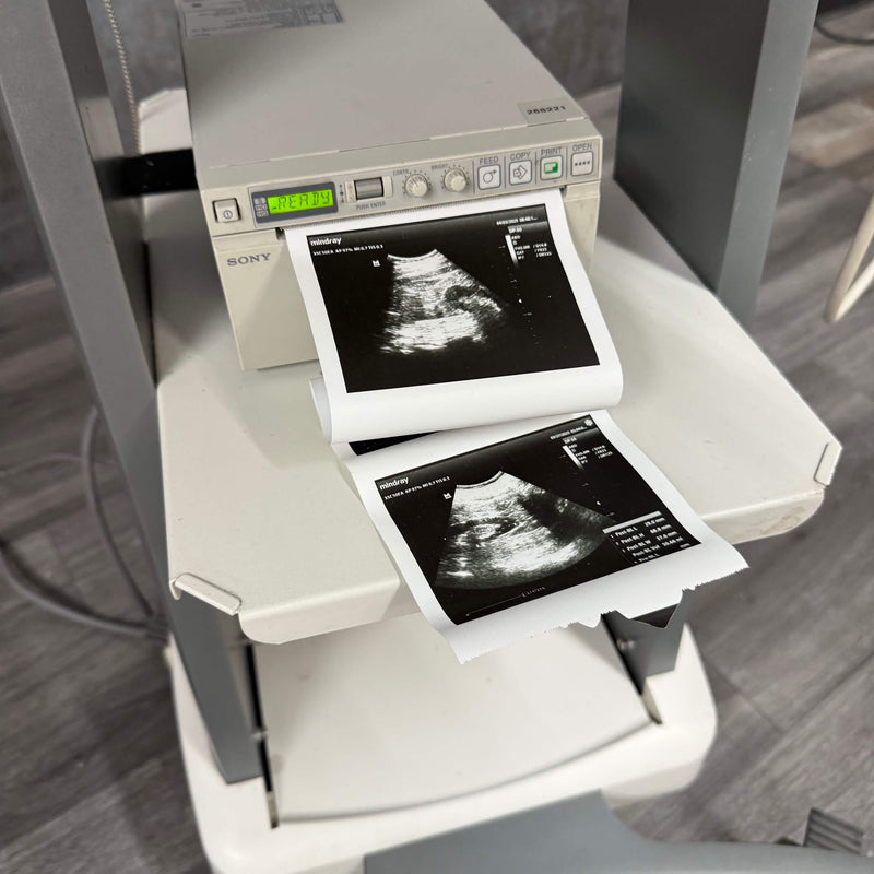 MIndray DP-50 with Sony Printer