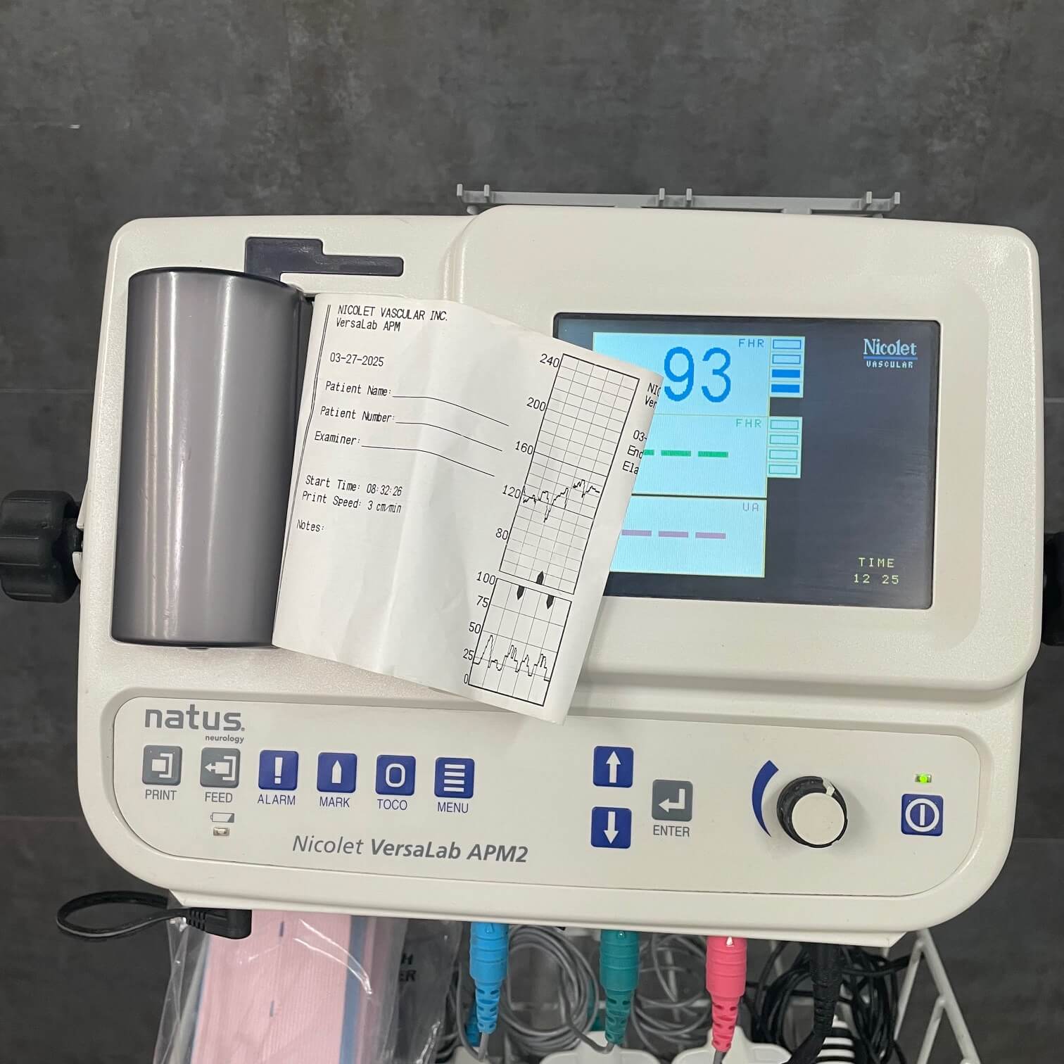 Natus Nicolet VersaLab APM2 fetal monitor w Mobile Stand - – Angelus ...