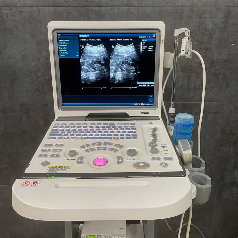 Mindray DP-50 Ultrasound Machine
