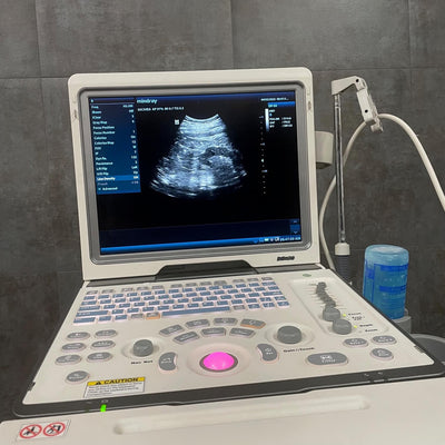 Mindray DP-50 Ultrasound Machine