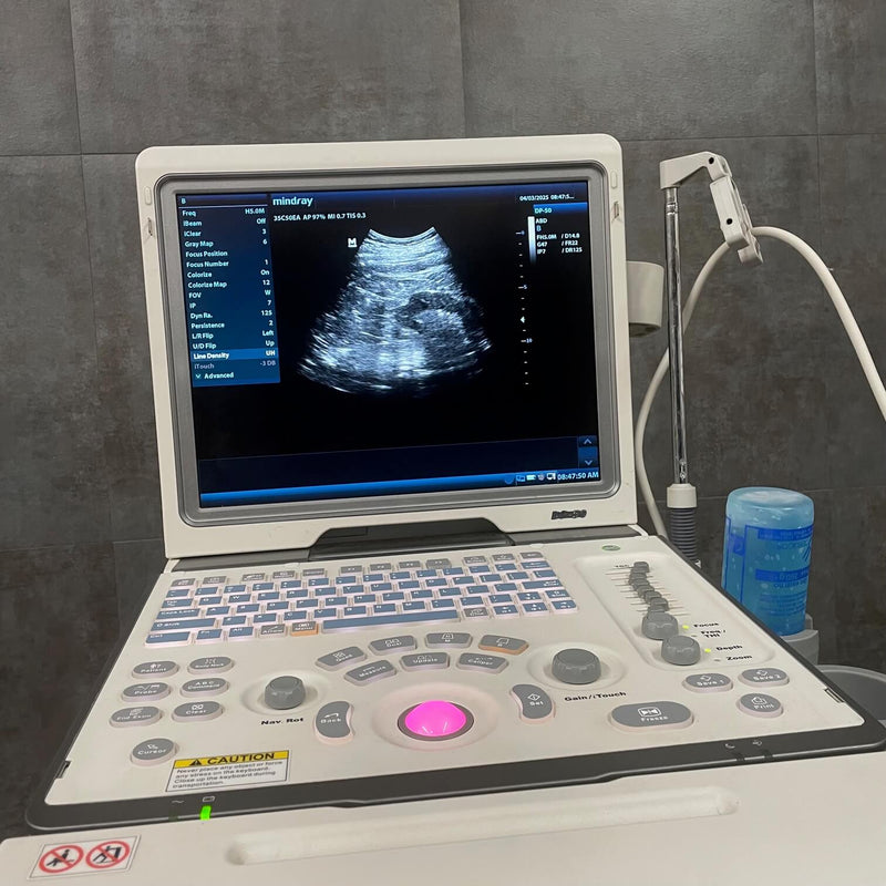 Mindray DP-50 Ultrasound Machine