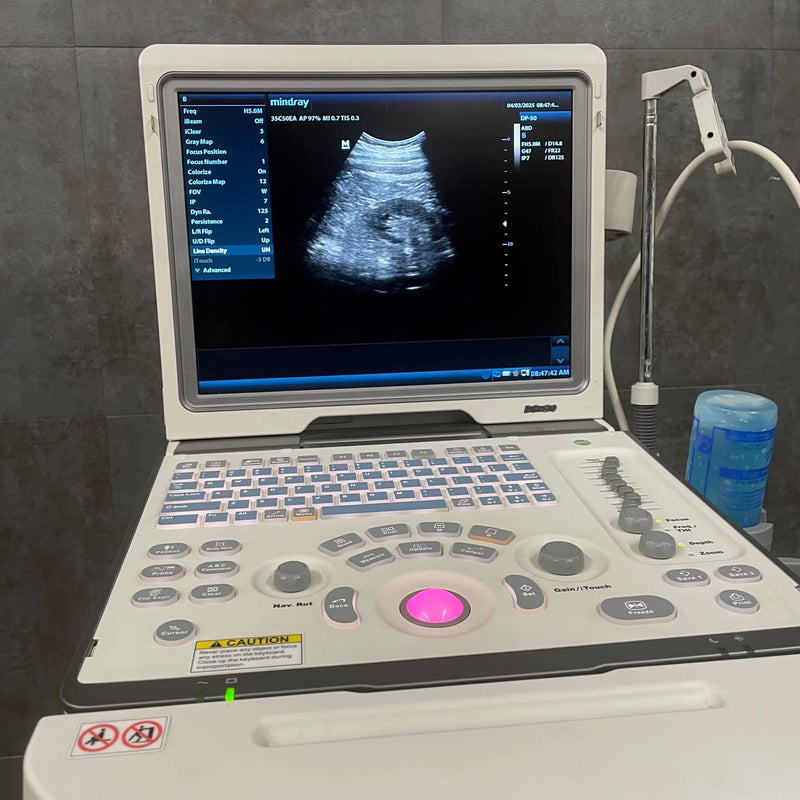 Dp50 Mindray DP-50 Ultrasound Machine with 35C50EA probe and Cart