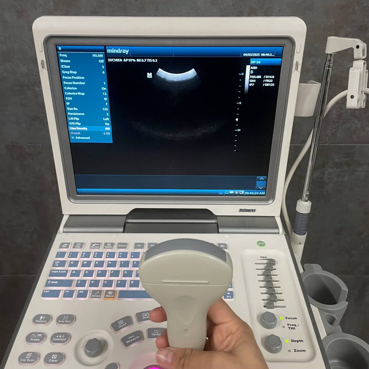 Mindray DP-50 Ultrasound Machine with 35C50EA probe and Cart ...