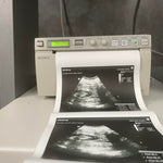 Mindray DP-50 Ultrasound Machine
