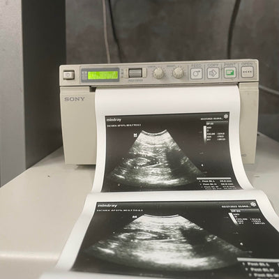 Mindray DP-50 Ultrasound Machine