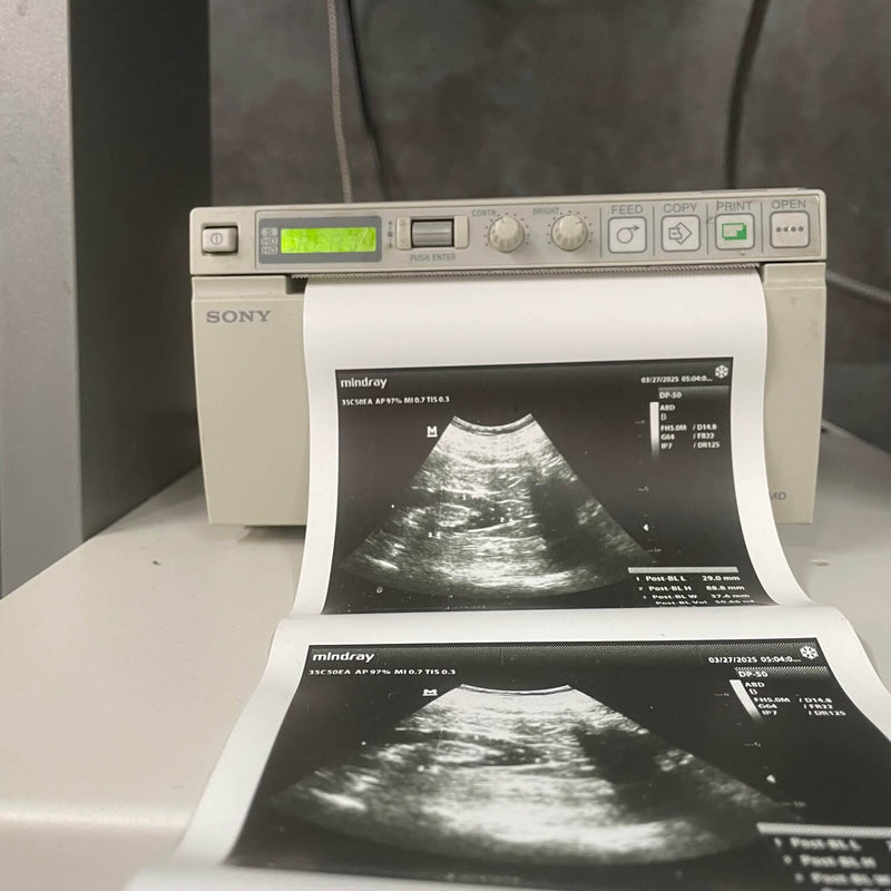 Mindray DP-50 Ultrasound Machine