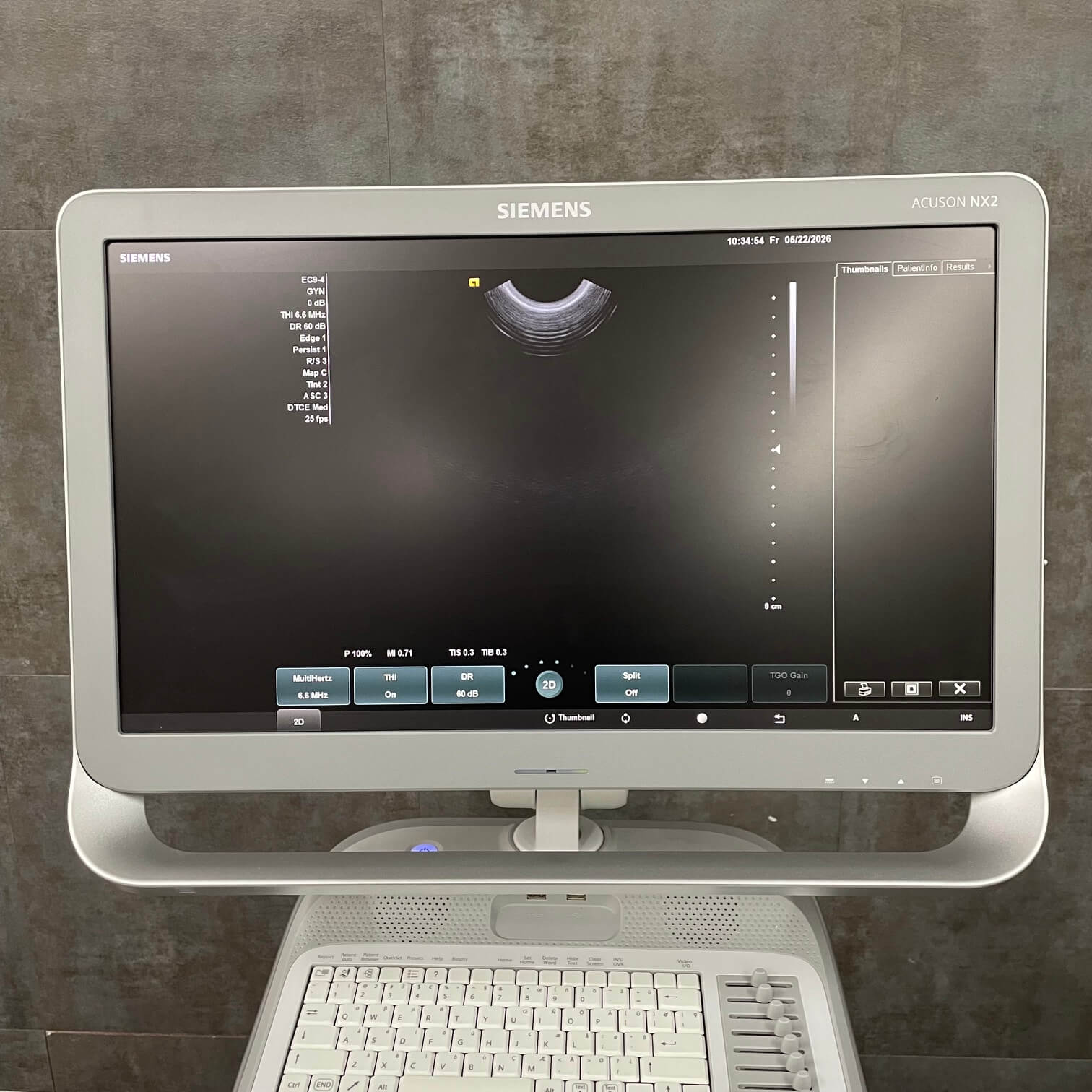 high resolution ultrasound imaging on Siemens NX2 system