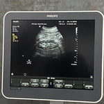 Philips Ultrasound
