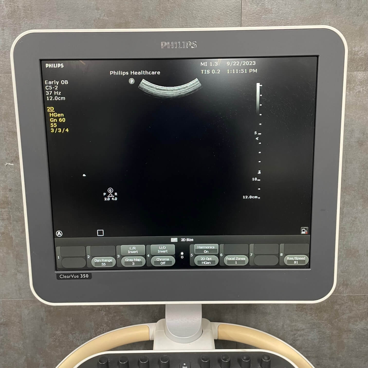 Philips ClearVue, Angelus Medical