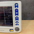 Criticare nCompass Monitor