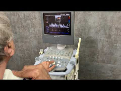 Siemens Acuson X150 Diangostic Ultrasound Acuson X150 Ultrasound #angelusmedical