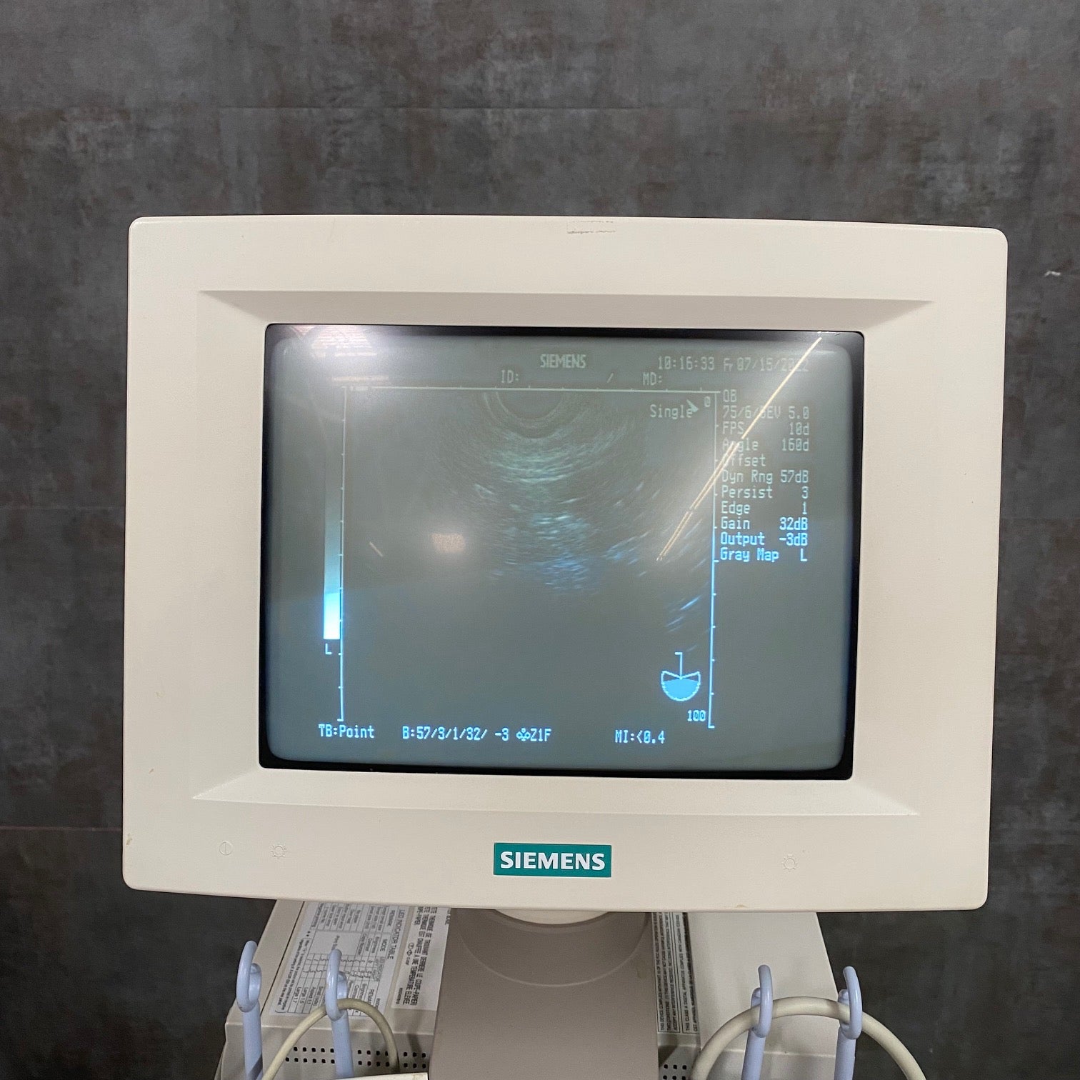 Siemens Sonoline Adara Diagnostic Ultrasound - Siemens -Angelus Medical