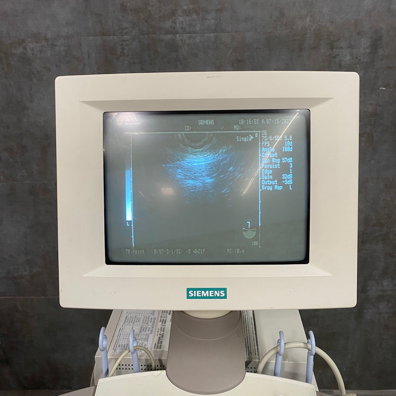 Siemens Sonoline Adara Diagnostic Ultrasound - Siemens -Angelus Medical