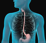 Endoscopy Equipment - Angelus Medical and Optical -Angelus Medical