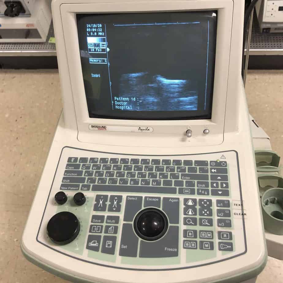 Esaote Biosound Portable Ultrasound (Used) - Esaote -Angelus Medical