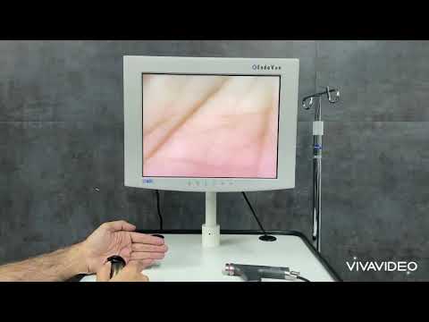 Karl Storz Image1 Complete System