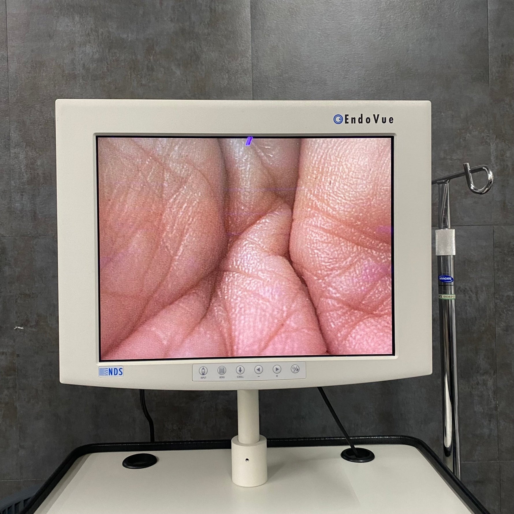 Karl Storz Image1 Complete System (Used) - Storz -Angelus Medical