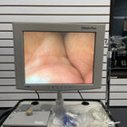 Karl Storz Image1 Complete System (Used) - Storz -Angelus Medical