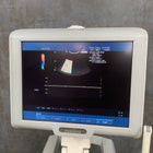 Medison SonoAce X6 Ultrasound - Medison -Angelus Medical
