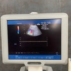 Medison SonoAce X6 Ultrasound - Medison -Angelus Medical