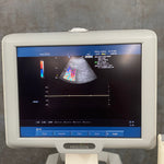 Medison SonoAce X6 Ultrasound - Medison -Angelus Medical