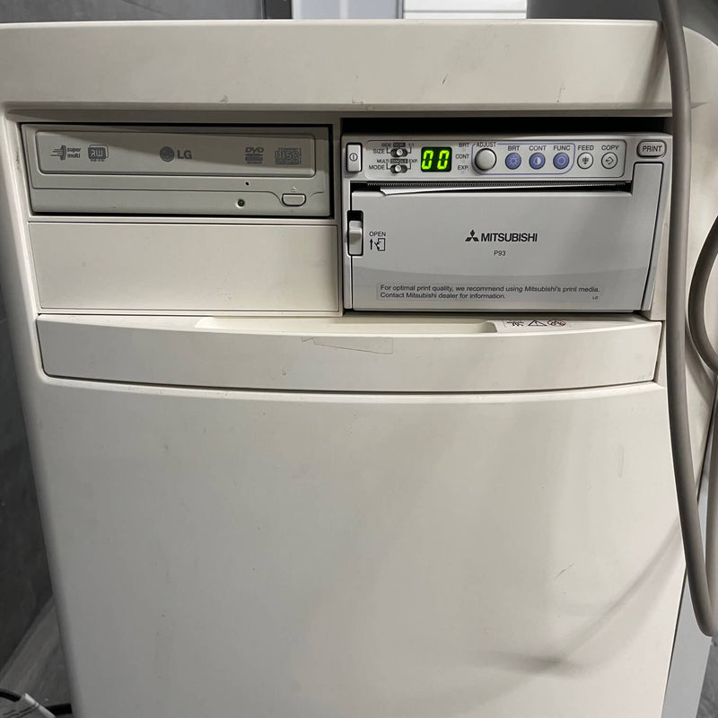 Siemens Acuson X150 Diangostic Ultrasound - Siemens -Angelus Medical