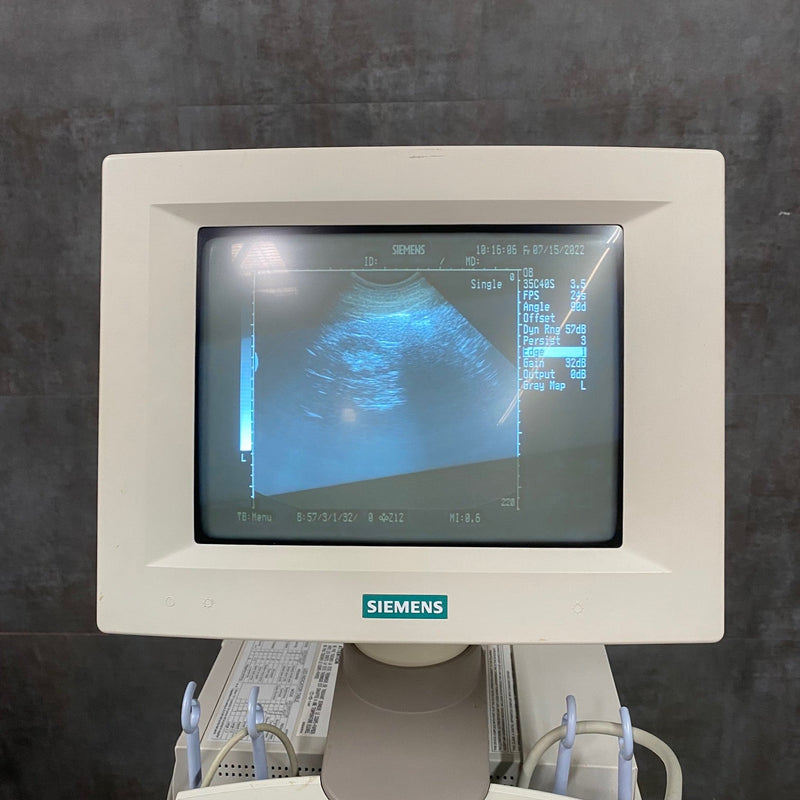 Siemens Sonoline Adara Diagnostic Ultrasound - Siemens -Angelus Medical