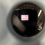 Titmus V4 Vision Screener - Honeywell -Angelus Medical