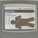 Welch Allyn Cp 100 ECG Price